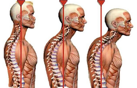 [Александр Волоткевич] Практические примеры коррекции осанки и фигуры в сагиттальной плоскости (2025