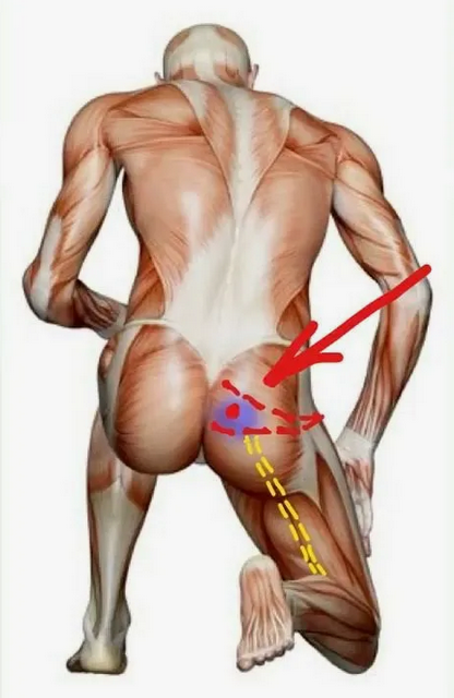 [Александр Волоткевич] Красивые ягодицы. Импиджмент ТБС. Синдром грушевидной мышцы (2025)