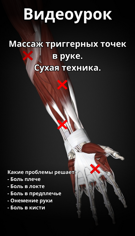 [Артём Пак] Массаж триггерных точек в руке (2024)