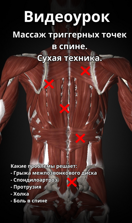 [Артем Пак] Массаж триггерных точек в спине (2024)