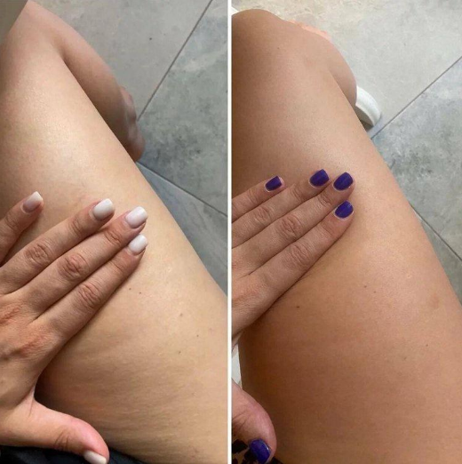 [Оксана Килина] Антидряблость (2022)