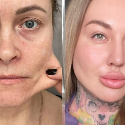 [Ярослава Науменко] Как сохранить красоту после 40 (2025) Оценок: 0  Автор темыRed Sun  Дата начала28.08.25